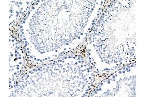 Phospho-YAP (Ser941) Antibody at 1/100 staining Rat testis tissue by IHC-P. (YAP1 Antikörper  (pSer941))