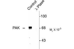 Western blots of rat hippocampal lysate showing specific immunolabeling of the ~68k to ~70k PAK protein (Control). (PAK1-3 (pThr402) Antikörper)