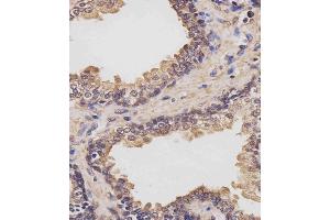 (ABIN6243855 and ABIN6577442) staining RK7 in human prostate tissue sections by Immunohistochemistry (IHC-P - raformaldehyde-fixed, raffin-embedded sections). (PARK7/DJ1 Antikörper  (C-Term))