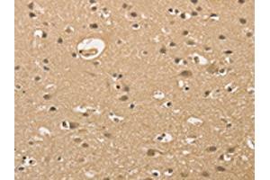 The image on the left is immunohistochemistry of paraffin-embedded Human brain tissue using ABIN7128351(ALDH8A1 Antibody) at dilution 1/30, on the right is treated with fusion protein.