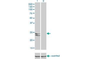 Western Blotting (WB) image for anti-RAB27A, Member RAS Oncogene Family (RAB27A) (AA 122-222) antibody (ABIN598569) (RAB27A Antikörper  (AA 122-222))