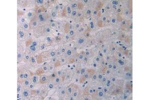 Immunohistochemistry (IHC) image for anti-Adaptor Protein, phosphotyrosine Interaction, PH Domain and Leucine Zipper Containing 1 (APPL1) (AA 404-673) antibody (ABIN5013082)