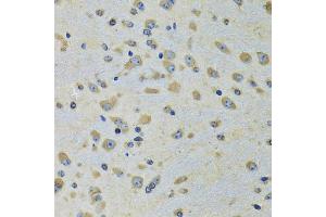 Immunohistochemistry of paraffin-embedded rat brain using DARS antibody (ABIN5973949) at dilution of 1/100 (40x lens). (DARS Antikörper)