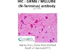 Image no. 1 for anti-Glutamate Receptor, Metabotropic 8 (GRM8) (Extracellular Domain), (N-Term) antibody (ABIN1735284) (GRM8 Antikörper  (Extracellular Domain, N-Term))