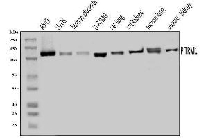 Western blot analysis of PITRM1 using anti-PITRM1 antibody (ABIN7601336).