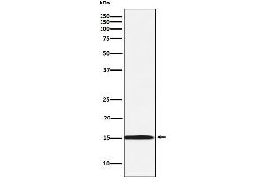 Western blot analysis of Ube2N / Ubc13 expression in Daudi cell lysate.