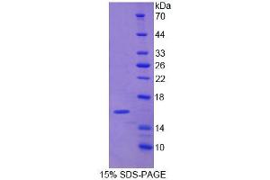 SDS-PAGE analysis of Human NARF Protein.