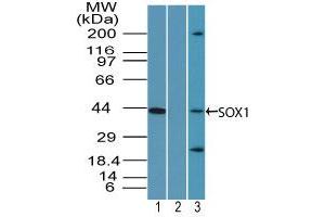 Image no. 1 for anti-SRY (Sex Determining Region Y)-Box 1 (SOX1) (AA 350-400) antibody (ABIN960349) (SOX1 Antikörper  (AA 350-400))
