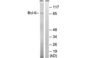 Western blot analysis of extracts from 293 cells, using Bcl-6 (Ab-333) Antibody. (BCL6 Antikörper  (AA 299-348))