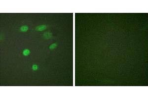 P-peptide - +Immunofluorescence analysis of HeLa cells, using CDC16/APC6 (Phospho-Ser560) antibody. (CDC16 Antikörper  (pSer560))