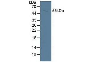Detection of LXRa in Porcine Spleen Tissue using Polyclonal Antibody to Liver X Receptor Alpha (LXRa) (NR1H3 Antikörper  (AA 95-434))