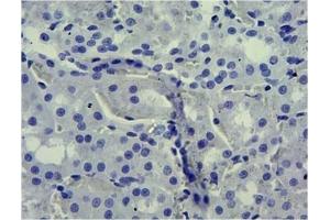 ABIN870680 Negative Control showing staining of paraffin embedded Rat Kidney, with no primary antibody. (SLC5A1 Antikörper  (Internal Region))