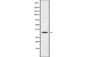 Western blot analysis SHOX using MCF7 whole cell lysates (SHOX Antikörper  (N-Term))