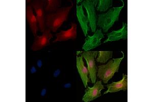 ABIN6257961 and ABIN6274900 staining  cells by IF/ICC.