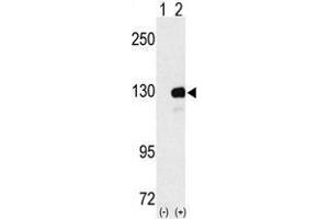 Image no. 1 for anti-UPF1 Regulator of Nonsense Transcripts Homolog (UPF1) (N-Term) antibody (ABIN357204) (RENT1/UPF1 Antikörper  (N-Term))