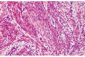 Human Muscle: Formalin-Fixed, Paraffin-Embedded (FFPE) (Vinculin Antikörper)