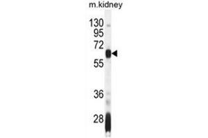 AIRE Antibody (Center) western blot analysis in mouse kidney tissue lysates (35 µg/lane). (AIRE Antikörper  (Middle Region))