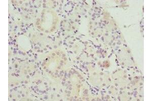 Immunohistochemistry of paraffin-embedded human pancreatic tissue using ABIN7145599 at dilution of 1:100 (Biliverdin Reductase Antikörper  (AA 1-296))