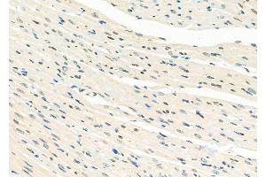 ABIN6265726 and ABIN6277994 at 1/100 staining Rat heart tissue by IHC-P. (TRIB3 Antikörper  (N-Term))