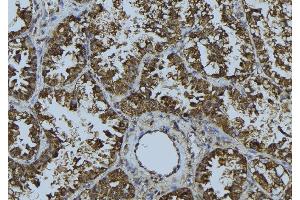 ABIN6268681 at 1/100 staining Mouse testis tissue by IHC-P.