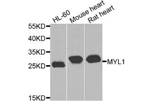 Western blot analysis of extracts of various cell lines, using MYL1 antibody (ABIN5974855) at 1/1000 dilution. (MYL1 Antikörper)