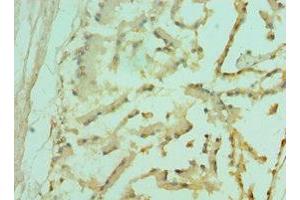 Immunohistochemistry of paraffin-embedded human prostate tissue using ABIN7153096 at dilution of 1:100 (FOXP2 Antikörper  (AA 416-715))