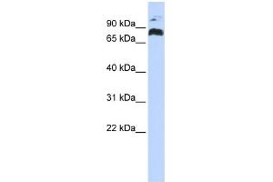 WB Suggested Anti-PHF21A Antibody Titration:  0. (PHF21A Antikörper  (Middle Region))
