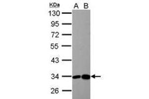 Image no. 4 for anti-3-hydroxyisobutyrate Dehydrogenase (HIBADH) (AA 1-257) antibody (ABIN1501919) (HIBADH Antikörper  (AA 1-257))