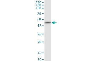 Immunoprecipitation of CALR3 transfected lysate using anti-CALR3 MaxPab rabbit polyclonal antibody and Protein A Magnetic Bead , and immunoblotted with CALR3 purified MaxPab mouse polyclonal antibody (B01P) . (Calreticulin 3 Antikörper  (AA 1-384))