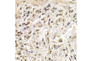 Immunohistochemistry (IHC) image for anti-Jun Proto-Oncogene (JUN) (AA 1-70) antibody (ABIN6213718) (C-JUN Antikörper  (AA 1-70))