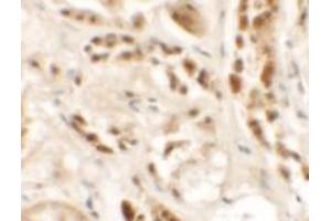 Immunohistochemical analysis of SIGLEC15 in human kidney tissue with SIGLEC15 polyclonal antibody  at 2. (SIGLEC15 Antikörper  (N-Term))
