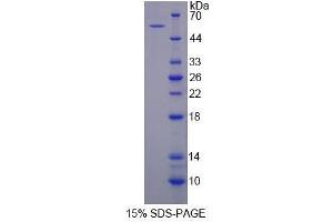 Image no. 1 for Tenascin XB (TNXB) (AA 3835-4088) protein (His tag,GST tag) (ABIN4988935) (TNXB Protein (AA 3835-4088) (His tag,GST tag))