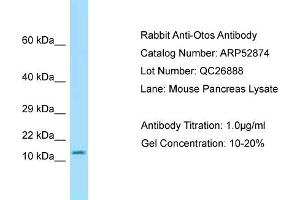 Western Blotting (WB) image for anti-Otospiralin (OTOS) (Middle Region) antibody (ABIN2785135)
