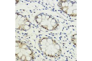Immunohistochemistry (IHC) image for anti-LIM Domain Binding 1 (LDB1) (AA 1-50) antibody (ABIN7268255)