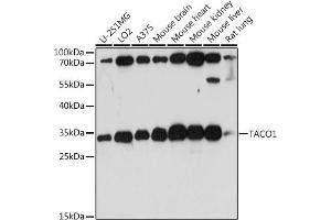 Western blot analysis of extracts of various cell lines, using T antibody (ABIN7266436) at 1:1000 dilution.