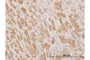 Image no. 1 for anti-N-Methylpurine-DNA Glycosylase (MPG) (AA 1-90) antibody (ABIN598820) (MPG Antikörper  (AA 1-90))