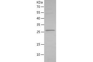 Western Blotting (WB) image for FXYD Domain Containing Ion Transport Regulator 3 (FXYD3) (AA 21-87) protein (His-IF2DI Tag) (ABIN7123021) (FXYD3 Protein (AA 21-87) (His-IF2DI Tag))