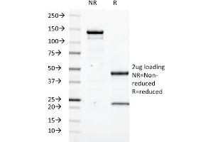 SDS-PAGE Analysis Purified Transglutaminase II Mouse Monoclonal Antibody (SPM358). (Transglutaminase 2 Antikörper)