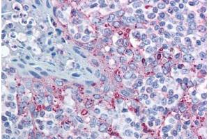 Human Tonsil (formalin-fixed, paraffin-embedded) stained with MTBP antibody ABIN213954 at 10 ug/ml followed by biotinylated goat anti-rabbit IgG secondary antibody ABIN481713, alkaline phosphatase-streptavidin and chromogen. (MTBP Antikörper  (AA 122-139))