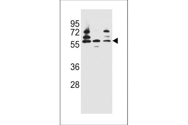 PDP 抗体  (AA 308-336)