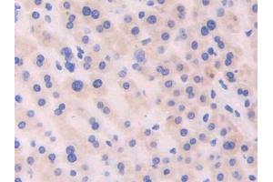 DAB staining on IHC-P; Samples: Human Liver Tissue (CDNF Antikörper  (AA 33-187))