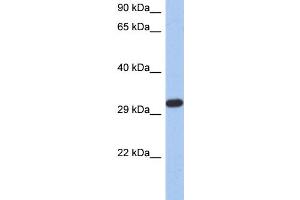 WB Suggested Anti-CAPZA3 Antibody Titration: 0. (CAPZA3 Antikörper  (N-Term))