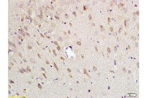 Formalin-fixed and paraffin embedded: rat brain tissue labeled with Anti-NK-2R Polyclonal Antibody , Unconjugated at 1:200 followed by conjugation to the secondary antibody and DAB staining (TACR2 Antikörper  (AA 223-300))
