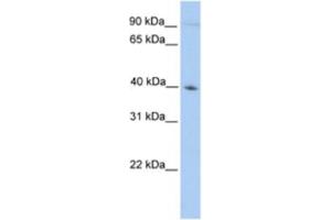 Western Blotting (WB) image for anti-Outer Dense Fiber of Sperm Tails 2 (ODF2) antibody (ABIN2463576) (ODF2 Antikörper)