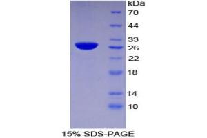 SDS-PAGE (SDS) image for Tissue Factor Pathway Inhibitor 2 (TFPI2) (AA 23-235) protein (His tag) (ABIN2122220)