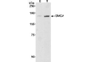 anti-Structural Maintenance of Chromosomes 2 (SMC2) (AA 950-1000) antibody