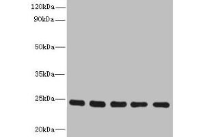 Western blot All lanes: RAB6B antibody at 5 μg/mL Lane 1: Mouse brain tissue Lane 2: U251 whole cell lysate Lane 3: MCF-7 whole cell lysate Lane 4: A549 whole cell lysate Lane 5: K562 whole cell lysate Secondary Goat polyclonal to rabbit IgG at 1/10000 dilution Predicted band size: 24, 23 kDa Observed band size: 24 kDa (RAB6B Antikörper  (AA 2-208))