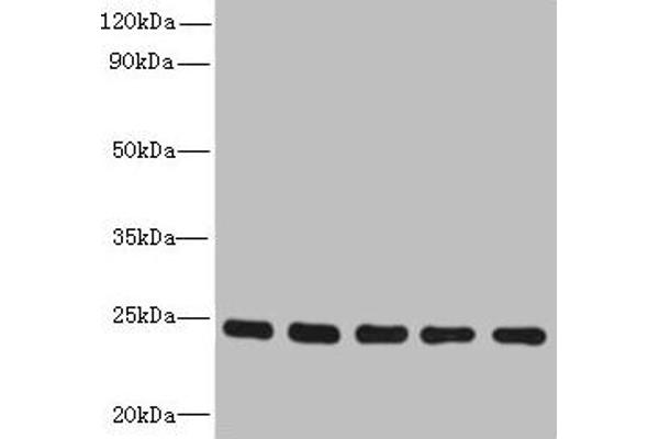 RAB6B Antikörper  (AA 2-208)