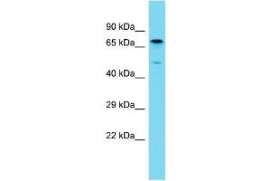 Host: Rabbit Target Name: BPIFB3 Sample Type: Fetal Liver lysates Antibody Dilution: 1.