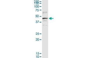 SERPINB2 MaxPab rabbit polyclonal antibody. (SERPINB2 Antikörper  (AA 1-415))